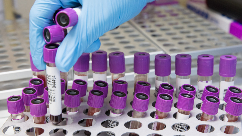 blood-ahmadardity-pixabay-945x532 Image: Blood samples. Credit: Ahmad Ardity via Pixabay
