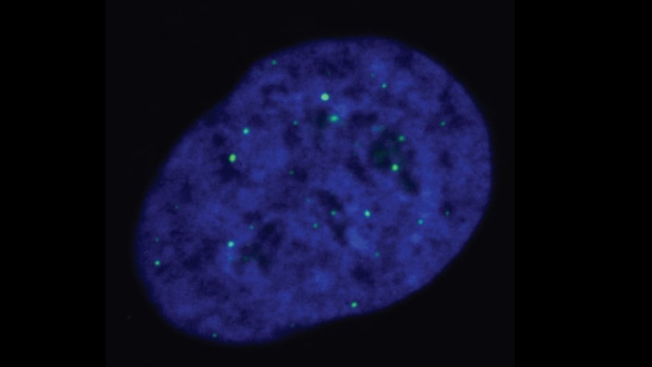 ALT-reliant cells, with telomeres being marked by the green dots. Credits: Cancer and Genome Stability Team at the ICR